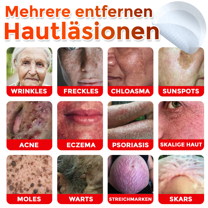🇩🇪🌈GFOUK® Mikronadeln Botanisch Hautanhängsel Entfernung Patch