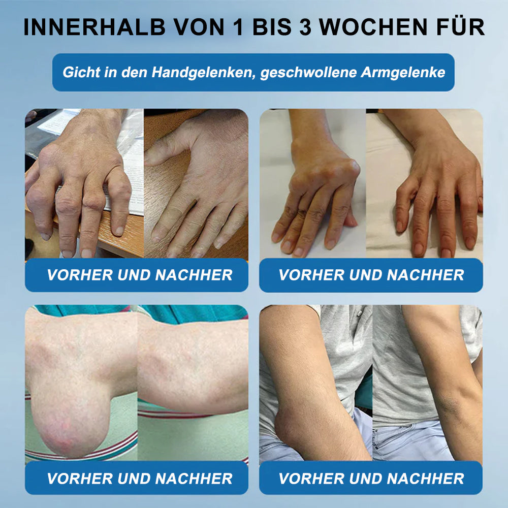 🇩🇪✨𝐟𝐥𝐲𝐬𝐦𝐮𝐬® 𝐁𝐏𝐂-𝟏𝟓𝟕 Gelenkheilcreme🦴Behandelt Arthritis, Neuropathie, Rheuma, Sportverletzungen und mehr🏆