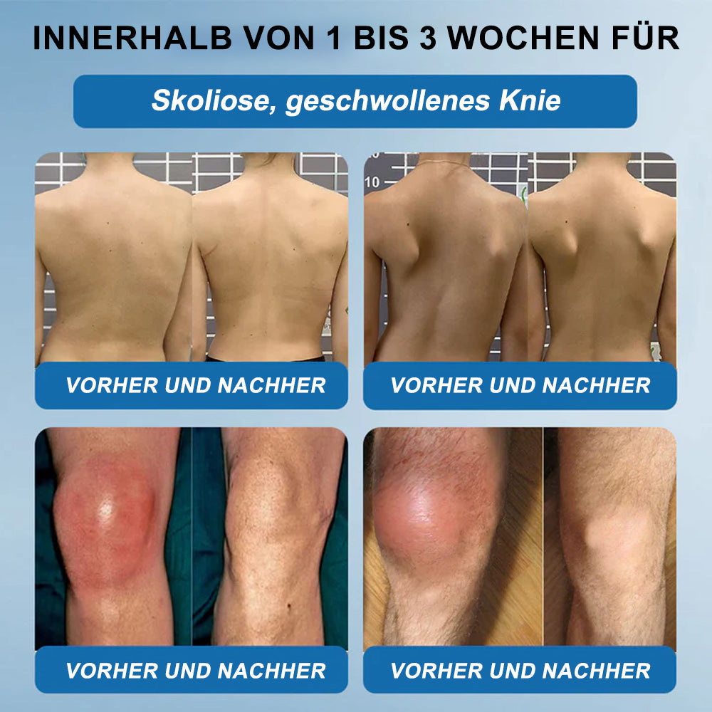 🇩🇪✨𝐟𝐥𝐲𝐬𝐦𝐮𝐬® 𝐁𝐏𝐂-𝟏𝟓𝟕 Gelenkheilcreme🦴Behandelt Arthritis, Neuropathie, Rheuma, Sportverletzungen und mehr🏆