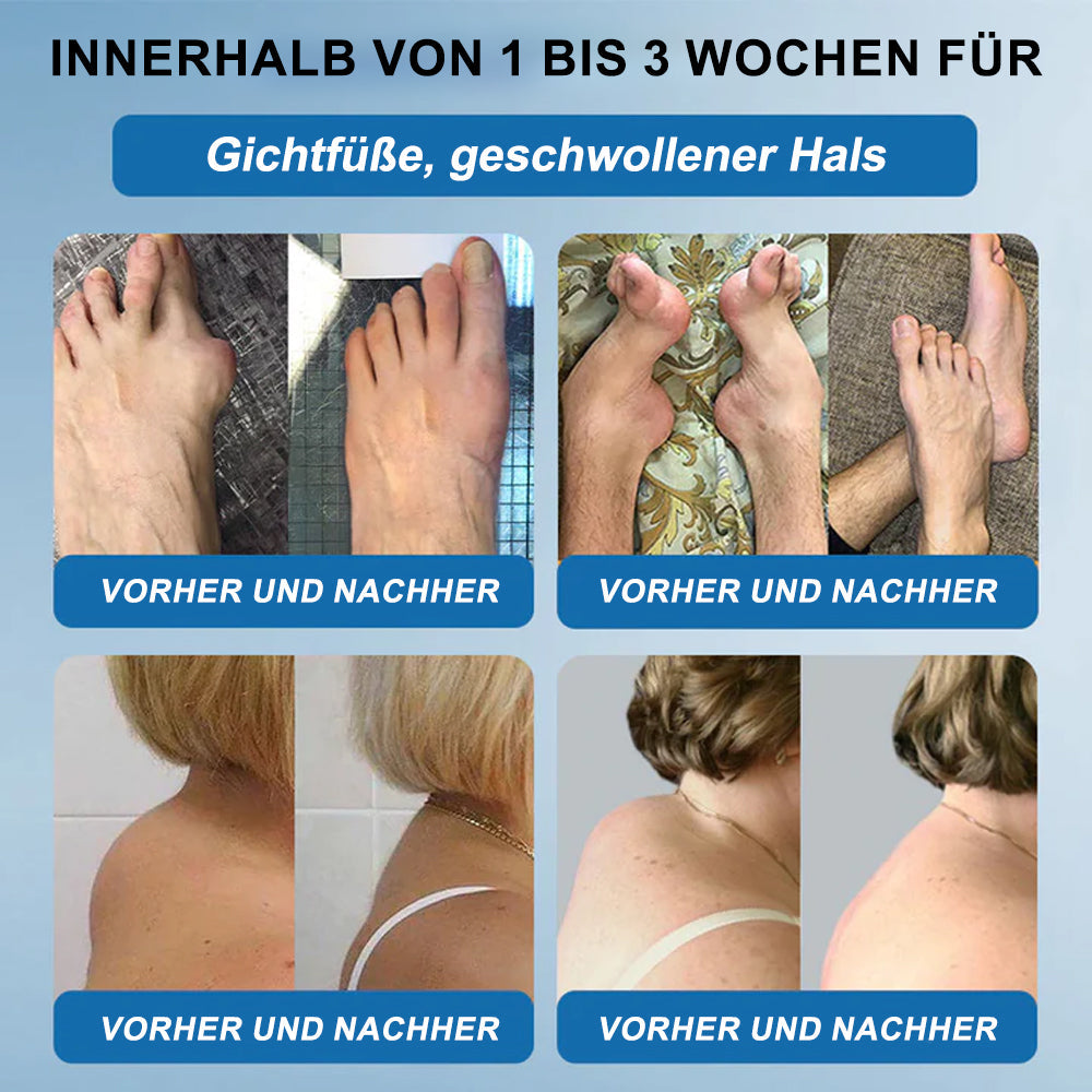 🇩🇪✨𝐟𝐥𝐲𝐬𝐦𝐮𝐬® 𝐁𝐏𝐂-𝟏𝟓𝟕 Gelenkheilcreme🦴Behandelt Arthritis, Neuropathie, Rheuma, Sportverletzungen und mehr🏆