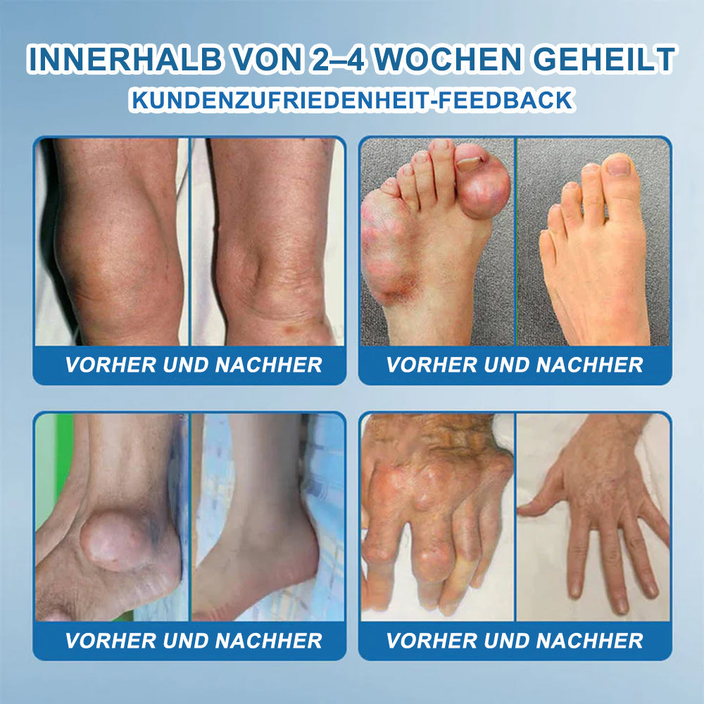 🇩🇪✨𝐟𝐥𝐲𝐬𝐦𝐮𝐬® 𝐁𝐏𝐂-𝟏𝟓𝟕 Gelenkheilcreme🦴Behandelt Arthritis, Neuropathie, Rheuma, Sportverletzungen und mehr🏆