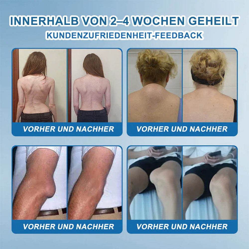 🇩🇪✨𝐟𝐥𝐲𝐬𝐦𝐮𝐬® 𝐁𝐏𝐂-𝟏𝟓𝟕 Gelenkheilcreme🦴Behandelt Arthritis, Neuropathie, Rheuma, Sportverletzungen und mehr🏆