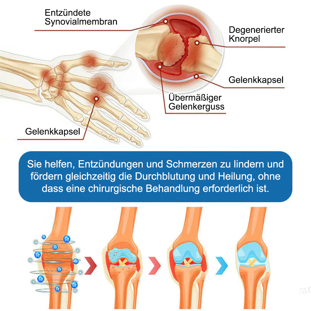 🇩🇪✨𝐟𝐥𝐲𝐬𝐦𝐮𝐬® 𝐁𝐏𝐂-𝟏𝟓𝟕 Gelenkheilcreme🦴Behandelt Arthritis, Neuropathie, Rheuma, Sportverletzungen und mehr🏆