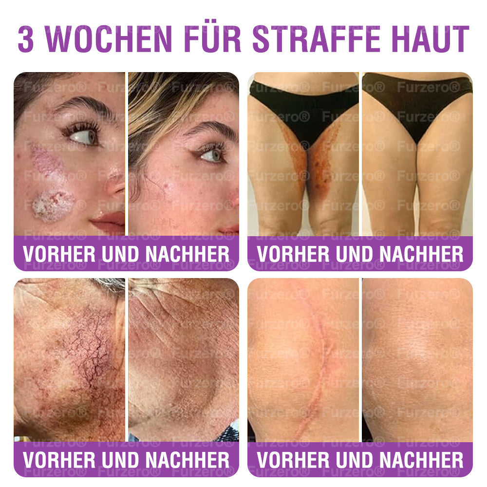 ๐ฉ๐ช๐นSicherheit gemรคร EU-Vorschriften geprรผft: ๐ญ๐๐๐๐๐๐ยฎ ๐ธ๐๐๐๐ ๐ต๐๐๐๐๐ ๐ท๐๐๐๐๐
๐ + ๐ฉ๐๐๐๐๐๐๐๐ ๐ฏ๐๐๐๐๐๐๐๐