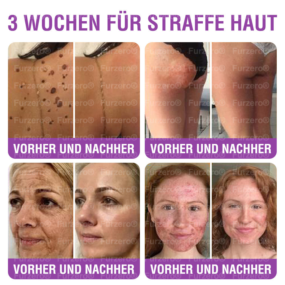 ๐ฉ๐ช๐นSicherheit gemรคร EU-Vorschriften geprรผft: ๐ญ๐๐๐๐๐๐ยฎ ๐ธ๐๐๐๐ ๐ต๐๐๐๐๐ ๐ท๐๐๐๐๐
๐ + ๐ฉ๐๐๐๐๐๐๐๐ ๐ฏ๐๐๐๐๐๐๐๐