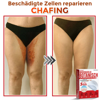 🇩🇪🌈GFOUK® Mikronadeln Botanisch Hautanhängsel Entfernung Patch