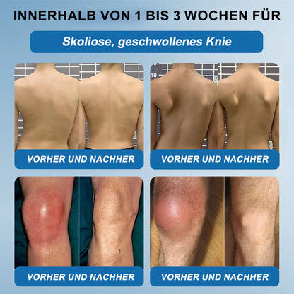 🇩🇪❤️𝐟𝐥𝐲𝐬𝐦𝐮𝐬® 𝐁𝐏𝐂-𝟏𝟓𝟕 Gelenkheilcreme🦴Behandelt Arthritis, Neuropathie, Rheuma, Sportverletzungen und mehr🏆