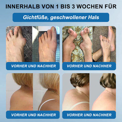 🇩🇪❤️𝐟𝐥𝐲𝐬𝐦𝐮𝐬® 𝐁𝐏𝐂-𝟏𝟓𝟕 Gelenkheilcreme🦴Behandelt Arthritis, Neuropathie, Rheuma, Sportverletzungen und mehr🏆