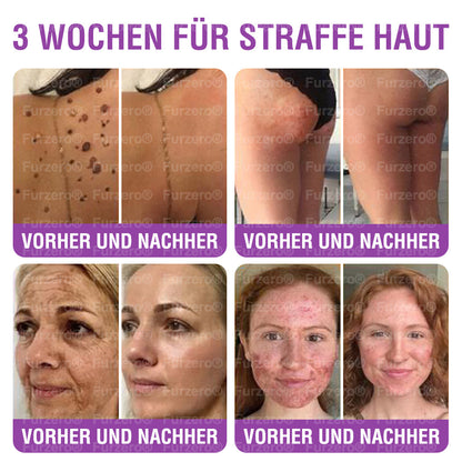 🇩🇪✳️Sicherheit gemäß EU-Vorschriften geprüft: 𝑭𝒖𝒓𝒛𝒆𝒓𝒐® 𝑸𝒖𝒆𝒆𝒏 𝑵𝒆𝒄𝒕𝒂𝒓 𝑷𝒆𝒑𝒕𝒊𝒅𝒆 + 𝑩𝒂𝒌𝒖𝒄𝒉𝒊𝒐𝒍 𝑯𝒂𝒖𝒕𝒄𝒓𝒆𝒎𝒆